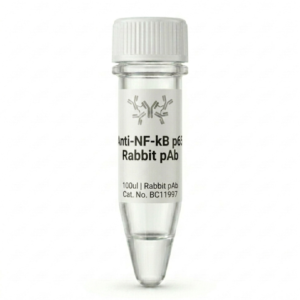 Anti-NF-kB p65 Rabbit Polyclonal Antibody 100ul