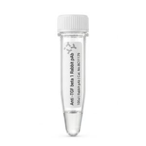 Anti-TGF beta 1 Rabbit pAb - 100ul
