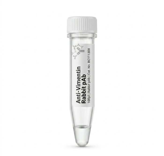 Anti-Vimentin Rabbit Polyclonal Antibody 100ul BC111308