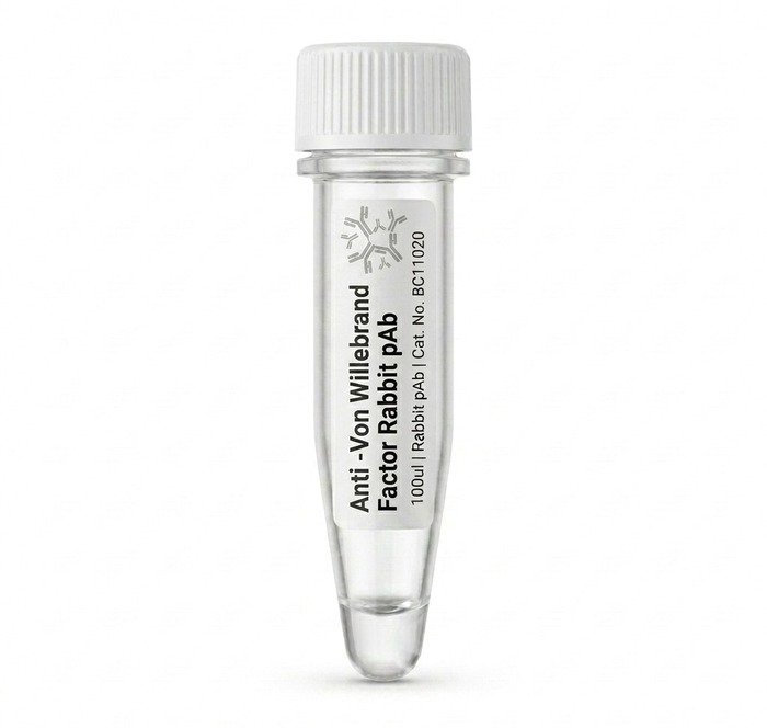 Anti-Von Willebrand Factor Rabbit pAb BC11020