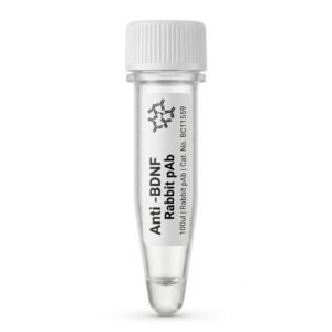 Anti-BDNF Rabbit Polyclonal Antibody 100ul