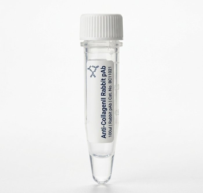 Anti-Collagen II Rabbit Polyclonal Antibody 100ul