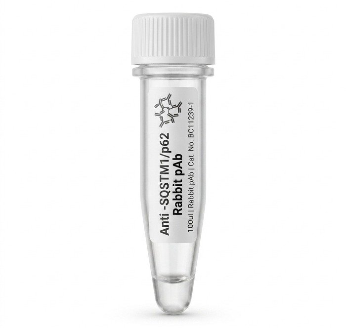 Anti-SQSTM1/p62 Rabbit Polyclonal Antibody 100ul