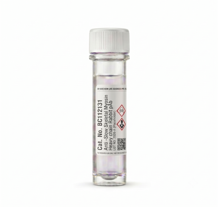Anti-Slow Skeletal Myosin Heavy Chain Rabbit pAb 100ul