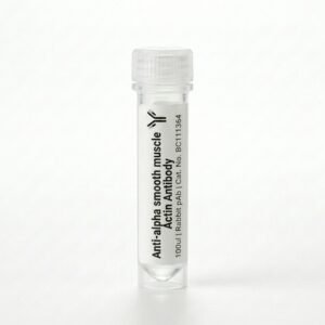 Anti-alpha smooth muscle Actin Rabbit pAb 100ul